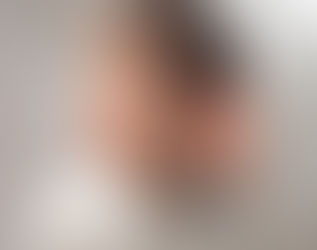 ¿Qué son los cuerpos extraños?