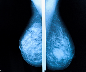 Añadir un subtítulo.png