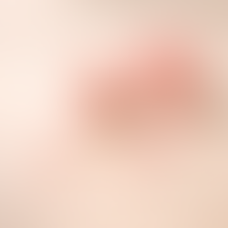 Rosenwasser – das Herz unserer Natural Glow Formel