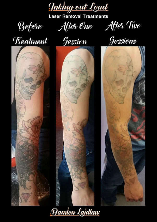 charlie full sleeve progress