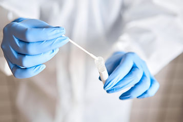 Doctor-holding-swab-test-tube-for-2019-nCoV-analyzing.-Coronavirus-test.-Blue-medical-glov