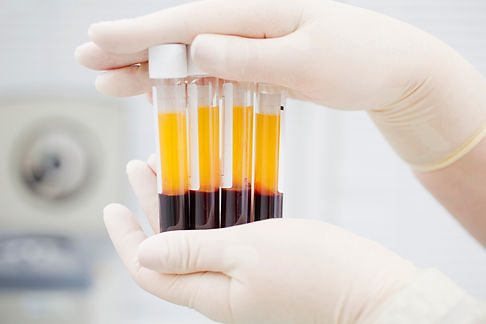 Preparing-blood-for-Plasmolifting.-531124111_727x484.jpeg