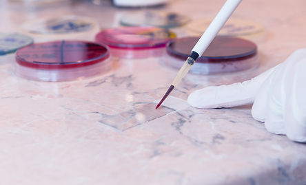 Researcher-preparing-for-a-smear-test-or-blood-film-470812544_762x462.jpeg