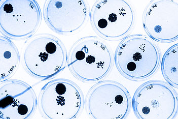 Growing-Bacteria-in-Petri-Dishes.-639988472_727x484.jpeg