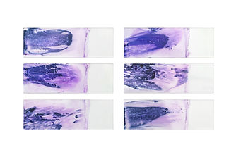 Set-of-glass-slides-after-thyroid-fine-needle-aspiration-biopsy,-slides-tissue-biopsy-for-