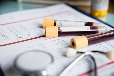 blood-test-tube-1183370025_727x485.jpeg