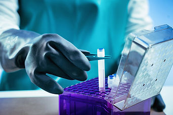 Biobanking.-Technician-preparing-biological-sample-for-deep-freezing-952307842_726x484.jpe