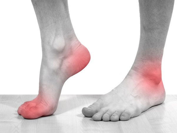 Tudo sobre Ácido Úrico: o que é, sintomas e porque pode estar alto