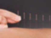 Eastbourne Clinic of Natural Medicine Acupuncture