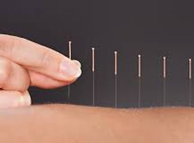 Eastbourne Clinic of Natural Medicine Acupuncture
