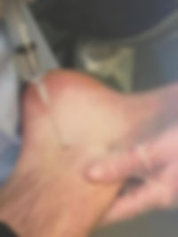 ree