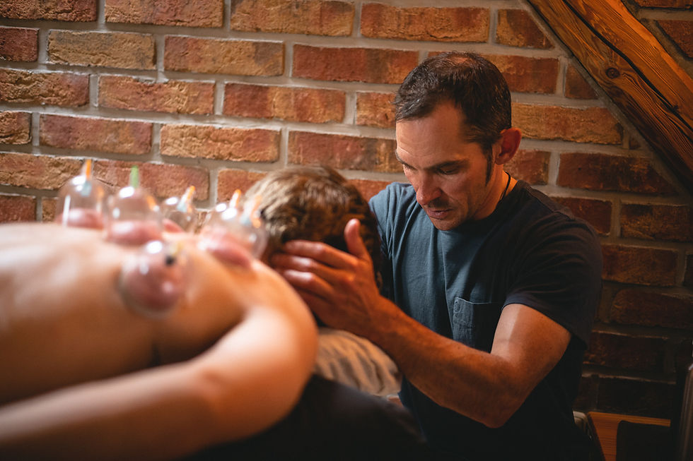 James Brickell doing a cupping treatment on athletes back