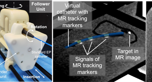 Best Experimental Paper 2022-2023, selected by Society for Cardiac Robotics Navigation  