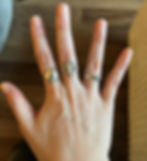 A hand with rings on showing no signs of damage from skin picking