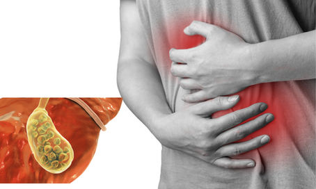 Comprehensive Explanation: Diet, Gallbladder Health, and the Role of Fats