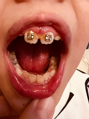 Respiratia, limba, musculatura si dintii 