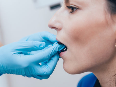 TMJ Jaw Treatment Christchurch