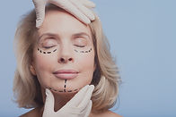 A facelift will help restore your appearance to a natural looking younger version of you.

