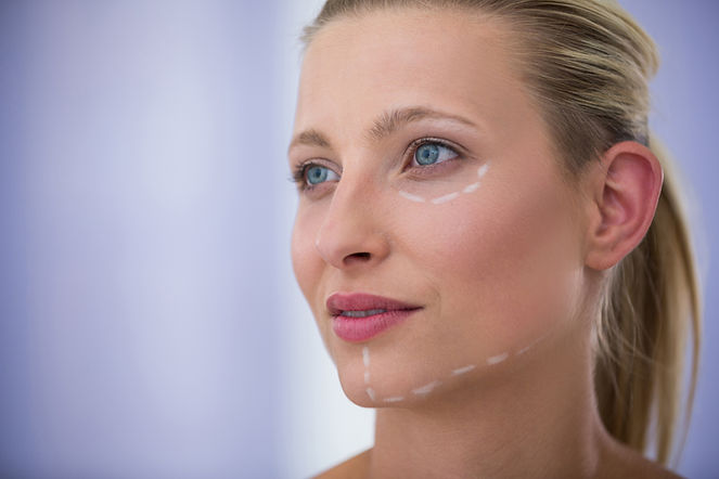 woman-with-marks-drawn-cosmetic-treatmen
