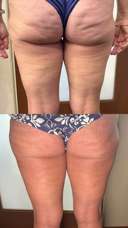 Before and After