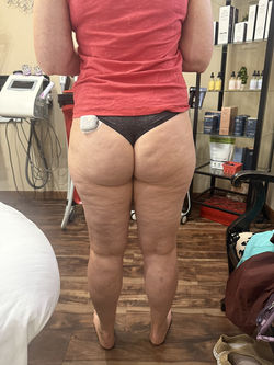 before back