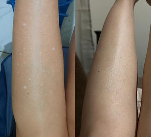 CAMULFLAGEM DE PINTAS.jpeg