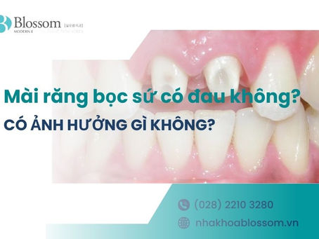 MÀI RĂNG BỌC SỨ CÓ ĐAU KHÔNG? CÓ ẢNH HƯỞNG GÌ KHÔNG?