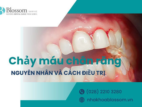 CHẢY MÁU CHÂN RĂNG DO ĐÂU? CÁCH ĐIỀU TRỊ NHƯ THẾ NÀO?