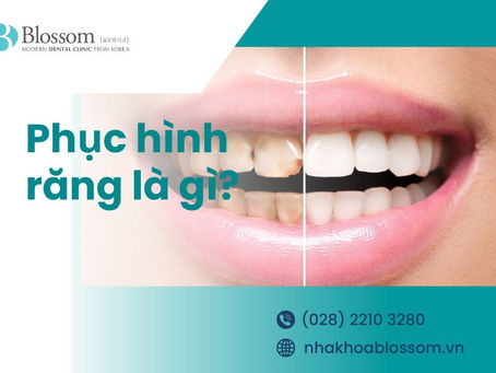PHỤC HÌNH RĂNG LÀ GÌ? CÁC PHƯƠNG PHÁP PHỤC HÌNH RĂNG PHỔ BIẾN