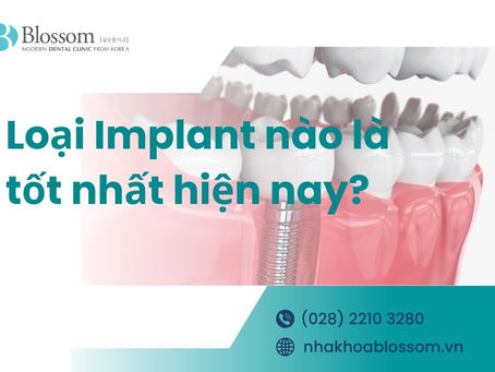 LOẠI IMPLANT NÀO LÀ TỐT NHẤT HIỆN NAY? – NHA KHOA BLOSSOM
