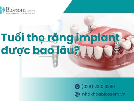 TUỔI THỌ RĂNG IMPLANT KÉO DÀI ĐƯỢC BAO LÂU?