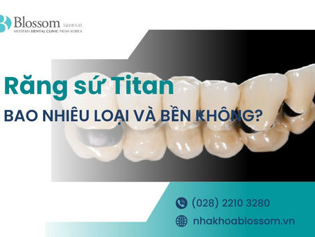 RĂNG SỨ TITAN LÀ GÌ? CÓ BAO NHIÊU LOẠI VÀ BỀN HAY KHÔNG?