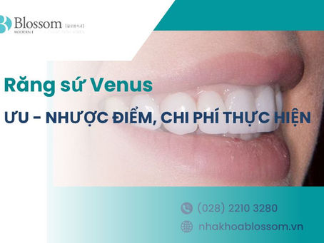 RĂNG SỨ VENUS: ƯU – NHƯỢC ĐIỂM, CHI PHÍ THỰC HIỆN