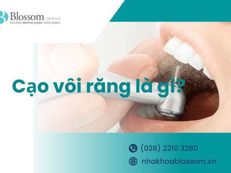 CẠO VÔI RĂNG LÀ GÌ? CÓ ẢNH HƯỞNG GÌ TỚI RĂNG KHÔNG?