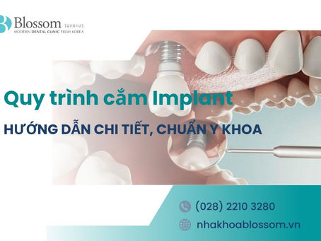 HƯỚNG DẪN QUY TRÌNH CẮM IMPLANT CHI TIẾT, CHUẨN Y KHOA