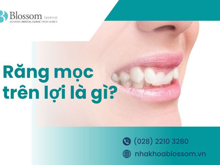 RĂNG MỌC TRÊN LỢI: NGUYÊN NHÂN VÀ CÁCH PHÒNG TRÁNH.