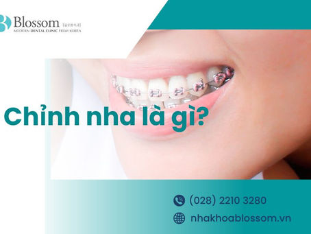 CHỈNH NHA LÀ GÌ? MỘT SỐ PHƯƠNG PHÁP CHỈNH NHA PHỔ BIẾN