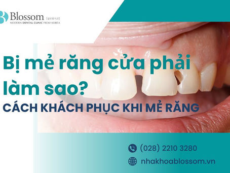 BỊ MẺ RĂNG CỬA PHẢI LÀM SAO? MẺ RĂNG CỬA KHẮC PHỤC RA SAO
