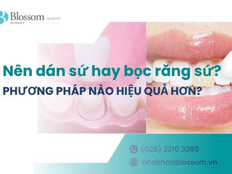 NÊN DÁN SỨ HAY BỌC RĂNG SỨ? PHƯƠNG PHÁP NÀO HIỆU QUẢ HƠN?