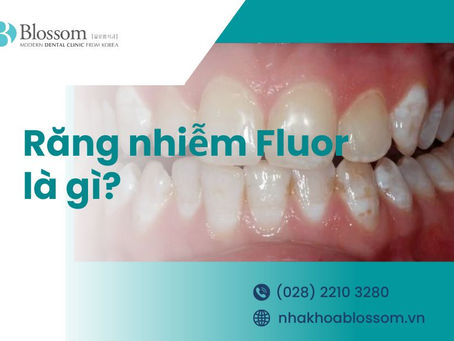RĂNG NHIỄM FLUOR LÀ GÌ? CÁCH ĐIỀU TRỊ NHƯ THẾ NÀO?