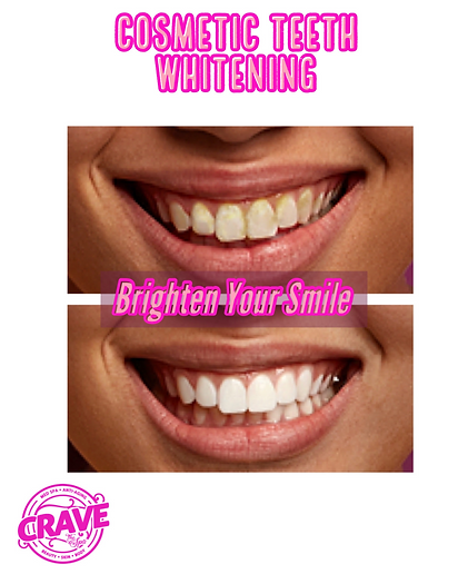 teeth whitening