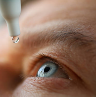 conjunctivitis