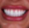 Iza 3.jpg