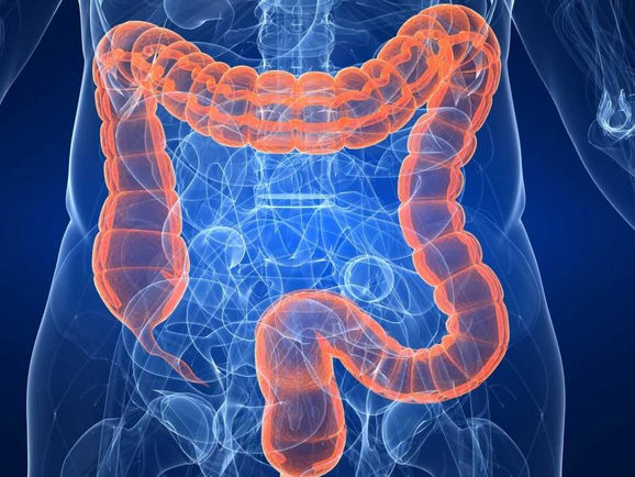 POR QUE PROBLEMAS INTESTINAIS LEVAM AO GANHO DE PESO?