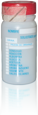 Muestras de orina