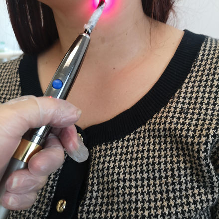 PHOTOBIOMODULATION THERAPY WITH LLLT IN PATIENTS WITH UNILATERAL VOCAL FOLD PARALYSIS.