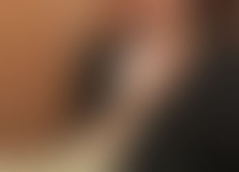 Ultrasonido y terapéutica vocal