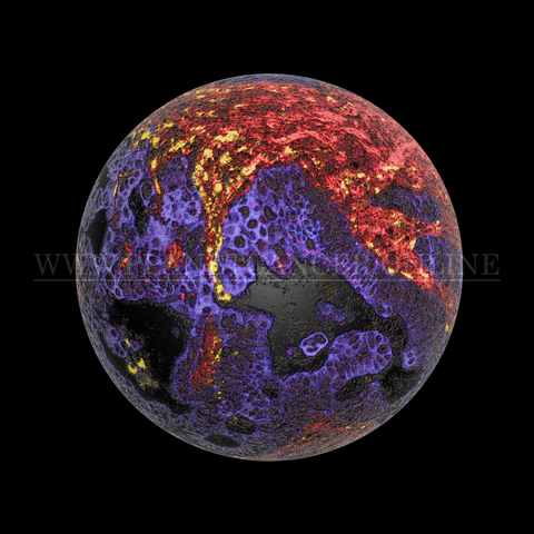 Planetcancer_18.png