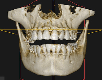 CBCT.jpeg