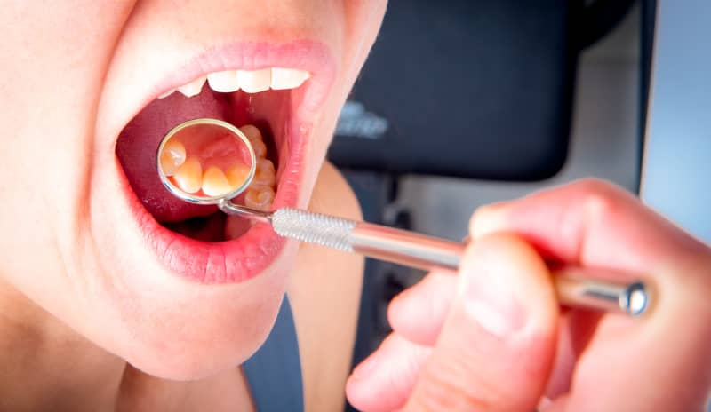 ¿Qué tipo de cáncer causa mal aliento?